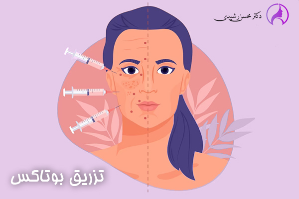 تزریق بوتاکس در زاهدان - دکتر محسن رشیدی