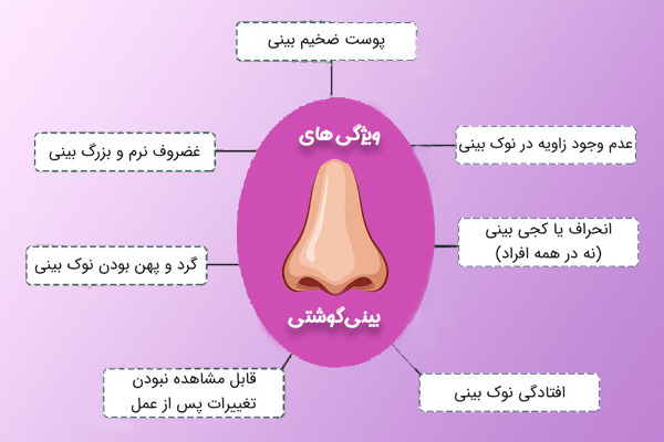 جراحی بینی گوشتی در زاهدان - دکتر محسن رشیدی