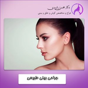 جراحی بینی طبیعی در زاهدان - دکتر محسن رشیدی