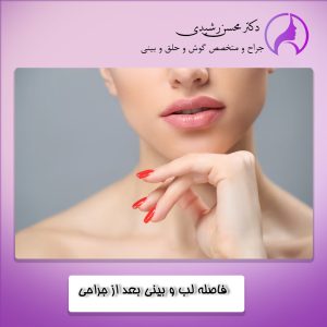 دلایل ایجاد فاصله بین لب و بینی بعد از جراحی بینی