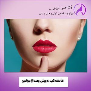 دلایل ایجاد فاصله بین لب و بینی بعد از جراحی بینی - دکتر محسن رشیدی