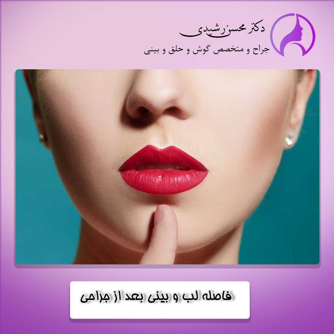 دلایل ایجاد فاصله بین لب و بینی بعد از جراحی بینی - دکتر محسن رشیدی