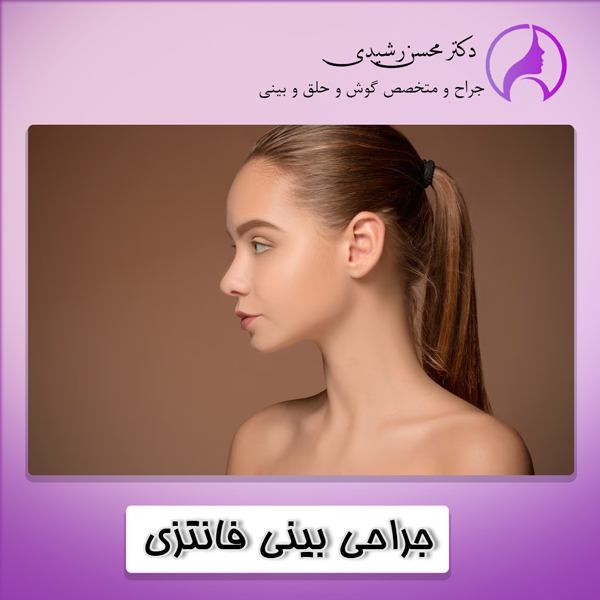 جراحی بینی فانتزی در زاهدان - دکتر محسن رشیدی