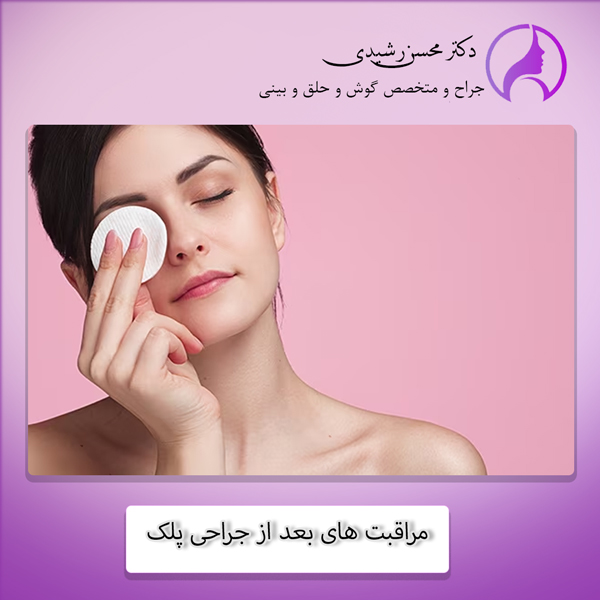 مراقبت های بعد از جراحی پلک - دکتر محسن رشیدی