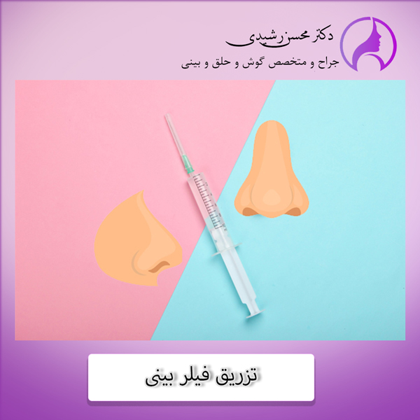 تزریق فیلر بینی - دکتر رشیدی