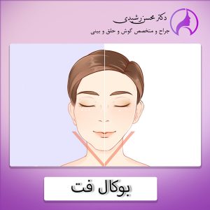 جراحی بوکال فت در زاهدان - دکتر محسن رشیدی