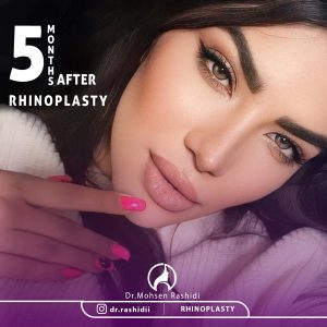 جراح بینی زاهدان - دکتر محسن رشیدی