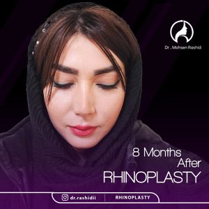 جراحی بینی استخوانی در زاهدان - دکتر رشیدی