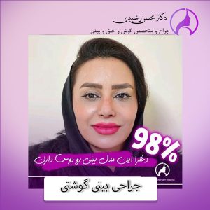 جراحی بینی گوشتی در زاهدان - دکتر محسن رشیدی