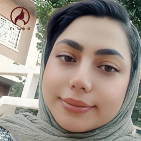 عکس نمونه کار جراح بینی زاهدان