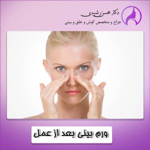 ورم بینی بعد از عمل