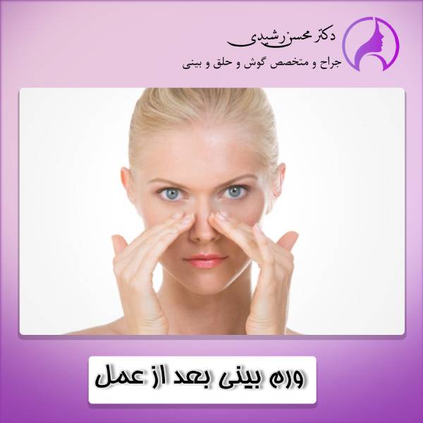 ورم بینی بعد از عمل